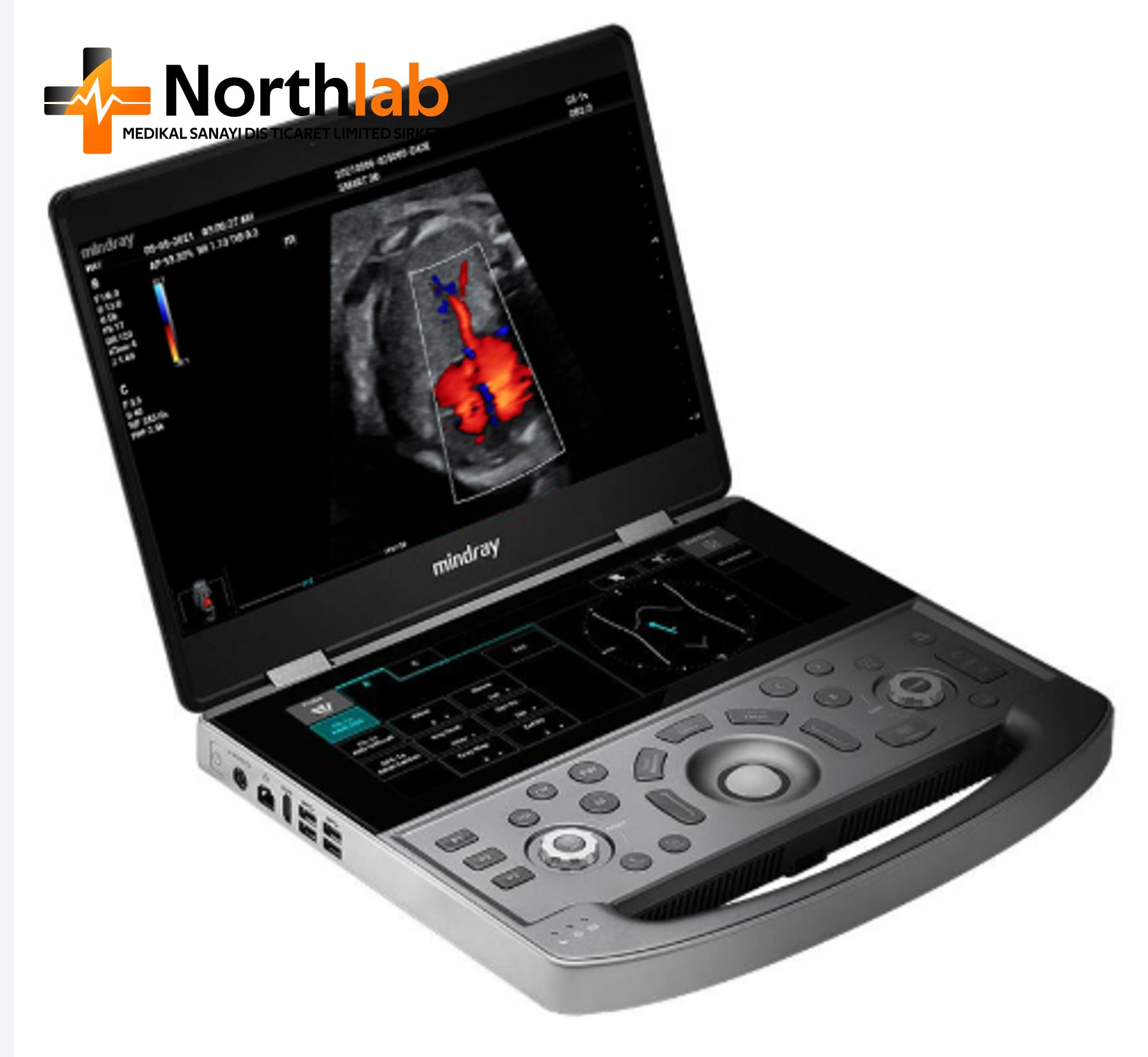 Portable Ultrasound Scanner (B/W Type)